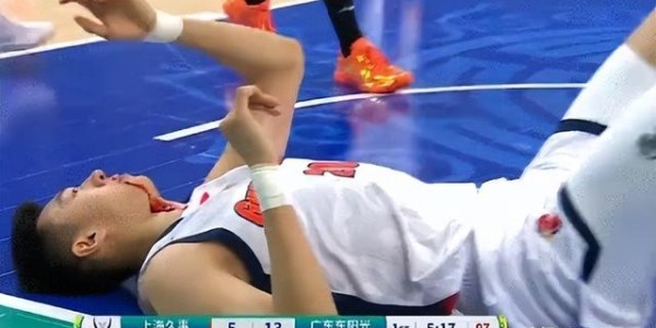 惨烈！王少杰鼻子被打出血被迫下场治疗引关注 杜锋脸如铁色